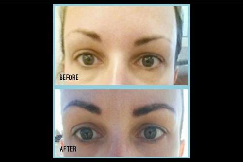 Before-and-after-1