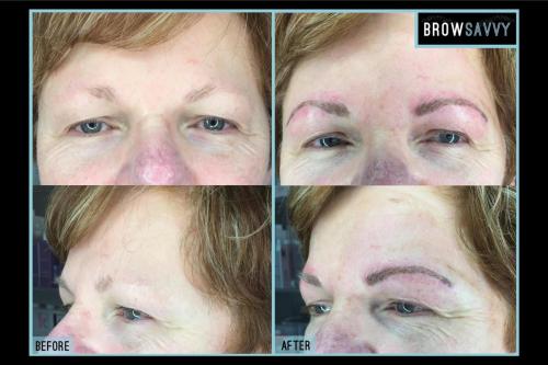 Before-and-after-10