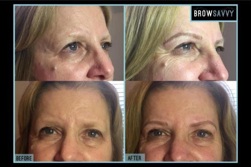 Before-and-after-11