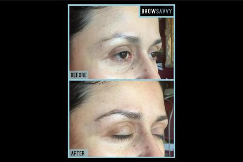 Before-and-after-14