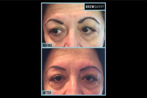 Before-and-after-15