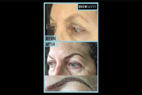 Before-and-after-18