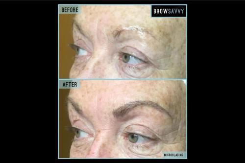 Before-and-after-19