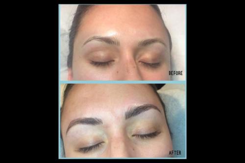 Before-and-after-2