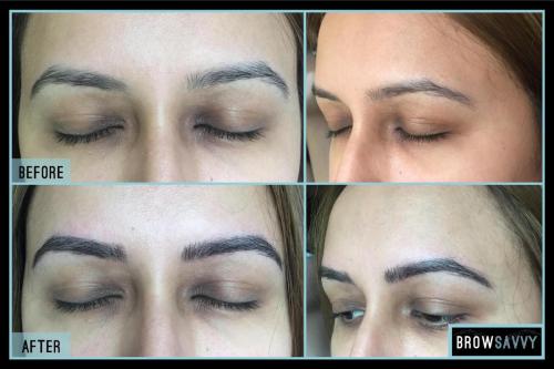 Before-and-after-21