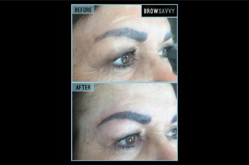 Before-and-after-22