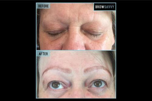Before-and-after-23