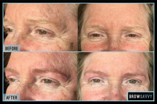 Before-and-after-24