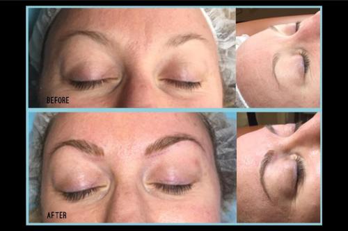 Before-and-after-3