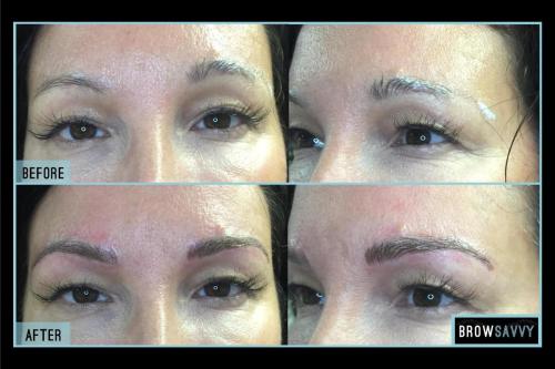 Before-and-after-31