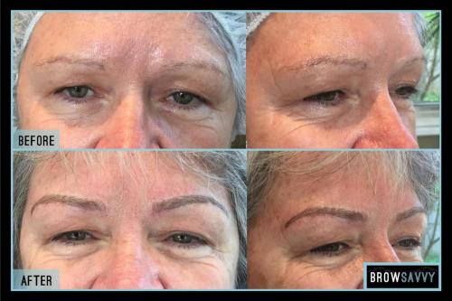 Before-and-after-32
