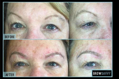 Before-and-after-33