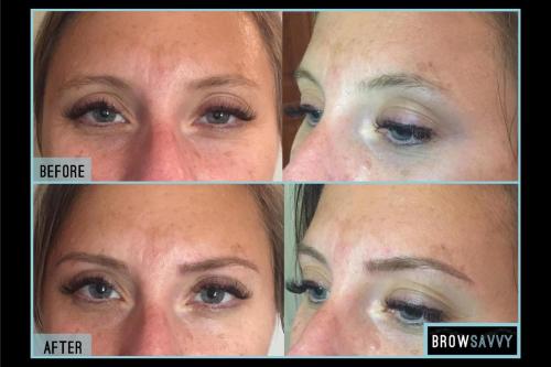 Before-and-after-34