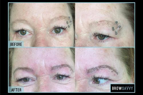 Before-and-after-35