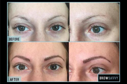 Before-and-after-36