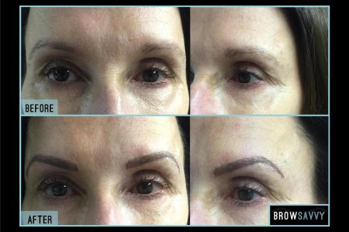 Before-and-after-37