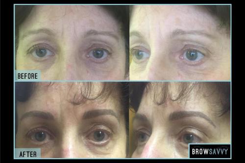 Before-and-after-38