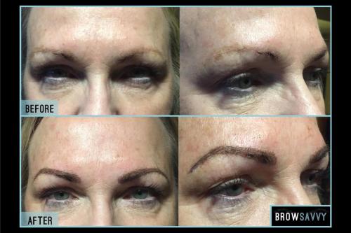 Before-and-after-39