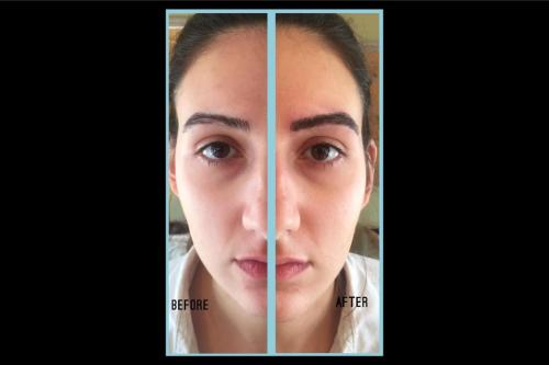Before-and-after-4