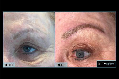 Before-and-after-40