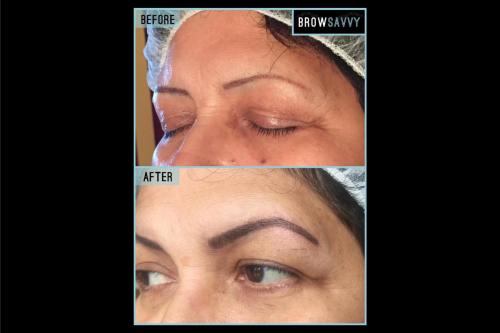 Before-and-after-41