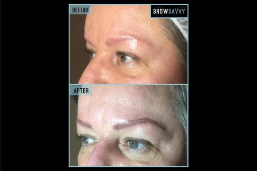 Before-and-after-42