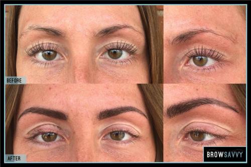 Before-and-after-43