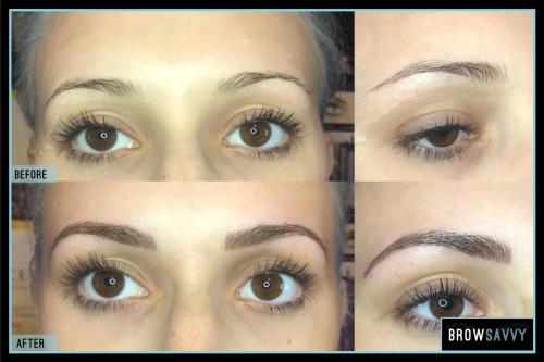 Before-and-after-44