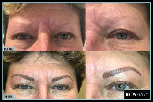 Before-and-after-45