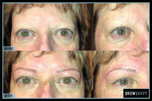 Before-and-after-46