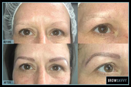 Before-and-after-47