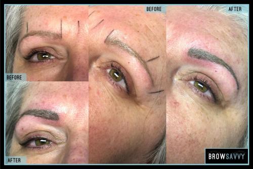 Before-and-after-48