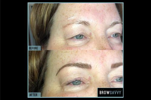 Before-and-after-49