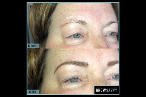Before-and-after-50