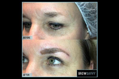 Before-and-after-51