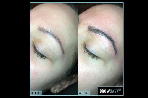 Before-and-after-52