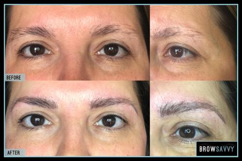 Before-and-after-53