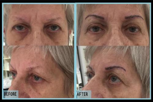 Before-and-after-6