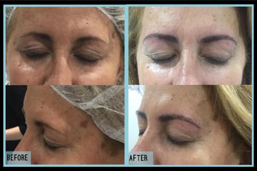 Before-and-after-7
