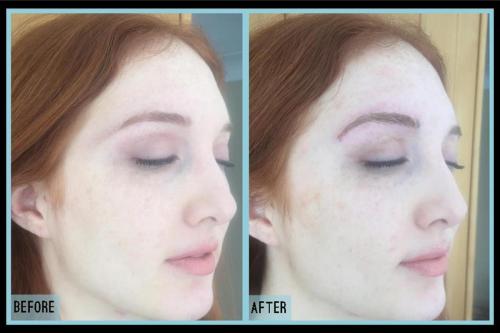 Before-and-after-8
