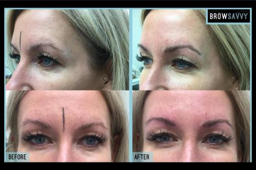 Before-and-after-9